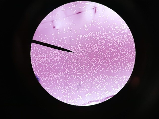 View of bacteria while looking through a microscope