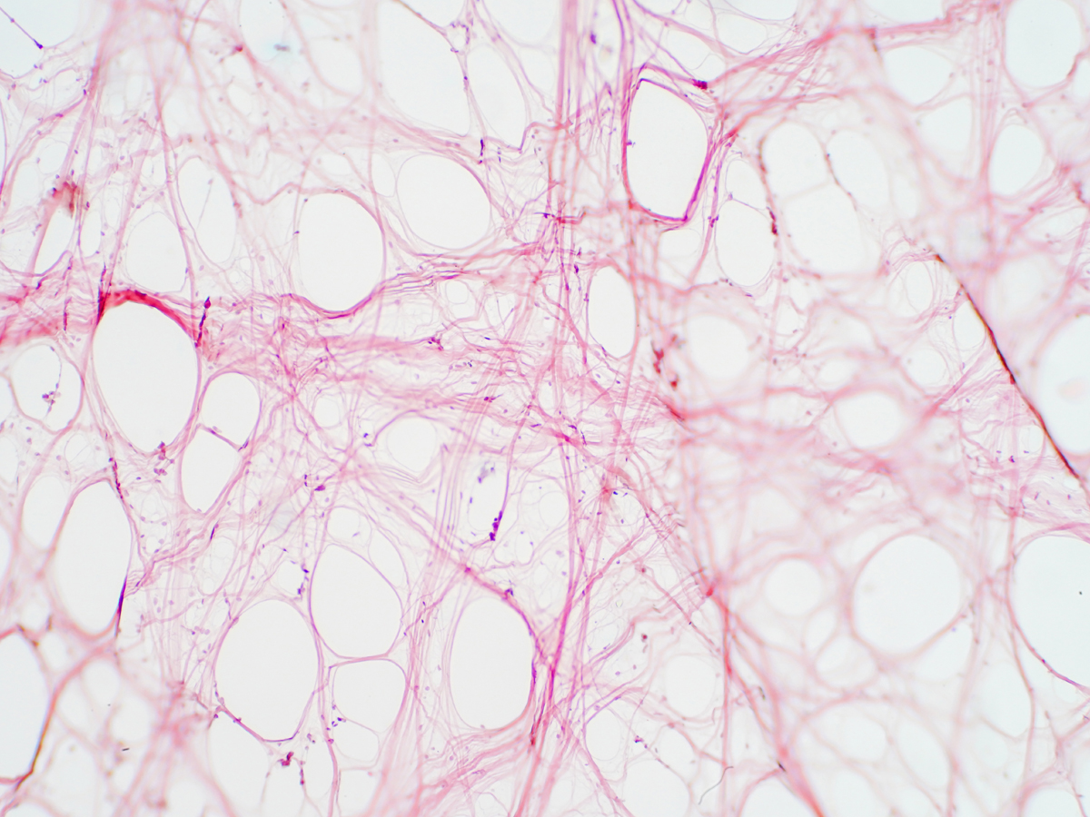 An enhanced image of connective tissue taken using a microscope